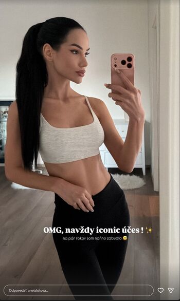 🔥 Anet slotova page leaked private photo uncensored full