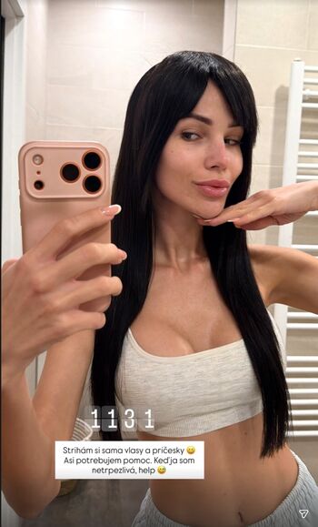 🔥 Anet slotova page leaked private photo uncensored full