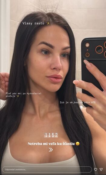 🔥 Anet slotova leaked private photo uncensored full