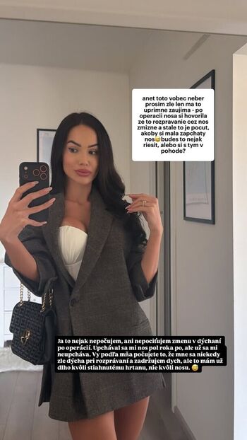 🔥 Anet slotova leaked private photo uncensored full