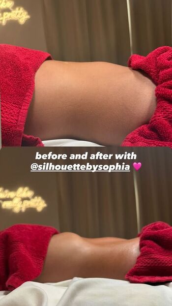 🔥 Mackenzie ziegler page leaked private photo uncensored full