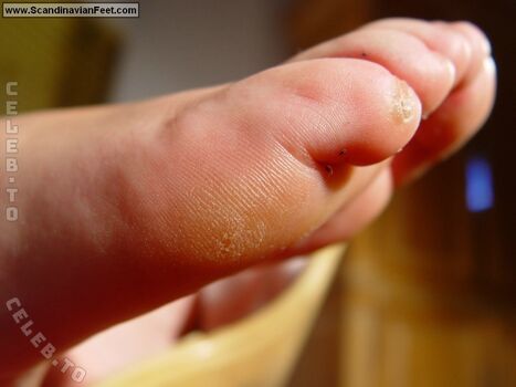 🔥 Scandinavian feet page leaked private photo uncensored full