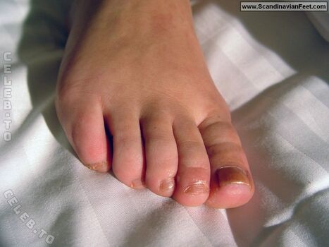 🔥 Scandinavian feet page leaked private photo uncensored full