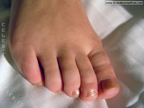 🔥 Scandinavian feet page leaked private photo uncensored full